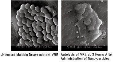 2. Induction of Autolysis of Multiple Drug-resistant VRE by Antibacterial Nano-particles (SEM × 15000)