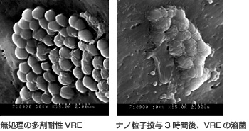 2．抗菌ナノ粒子の多剤耐性VRE溶菌誘導（SEM ×15,000）