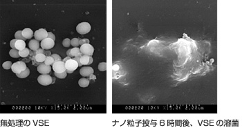 3．抗菌ナノポリマー粒子のVSE溶菌誘導（SEM ×15,000）